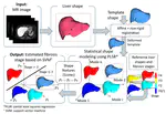 Liver shape analysis using partial least squares regression-based statistical shape model: application for understanding and staging of liver fibrosis