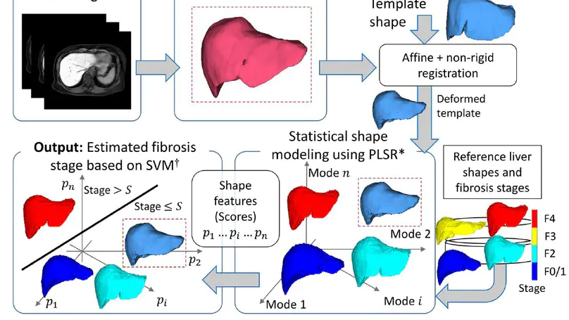 Liver shape analysis using partial least squares regression-based statistical shape model: application for understanding and staging of liver fibrosis