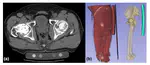 Automated segmentation of an intensity calibration phantom in clinical CT images using a convolutional neural network