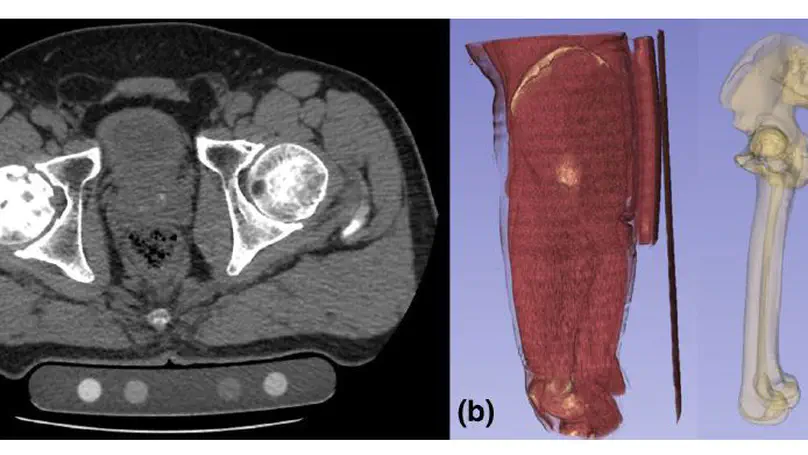 Automated segmentation of an intensity calibration phantom in clinical CT images using a convolutional neural network