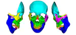 Deep-learning-based automatic facial bone segmentation using a two-dimensional U-Net