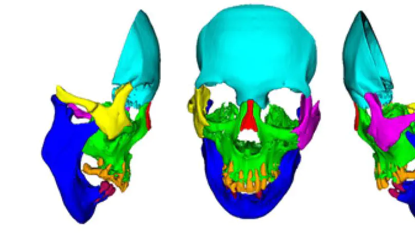 Deep-learning-based automatic facial bone segmentation using a two-dimensional U-Net